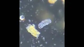 Tardigrade from a Moss sample