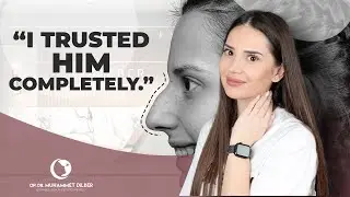 Vladimira's Remarkable Transformation: Nose Surgery by Dr. Muhammet Dilber