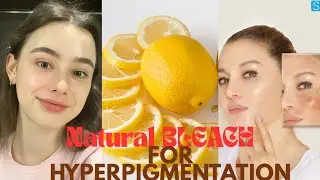 Natural Bleach For Remove Hyperpigmentation