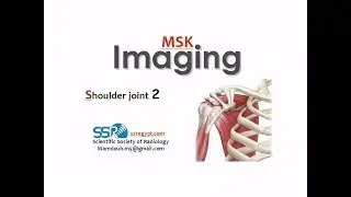 التصوير بالرنين المغناطيسي للكتف 2 Shoulder MRI