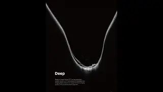 Image Gallery of DREAM OCT Intalight