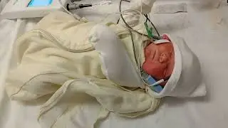 Newborn Baby Ada Gets Hearing Test 👶🏻👂🏻 24 Hours Old