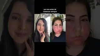 REACCI&Oacute;N EN LA PIEL
