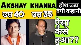 Akshay Khanna गंजे क्यू हुए - Akshay Khanna baldness reason - Inspirational story