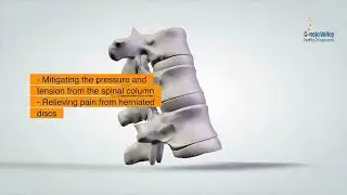 Effective Techniques Performed by the Chiropractors for Treating Herniated Discs