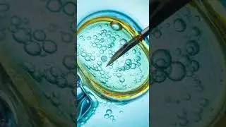 Frozen Embryos Linked to High Blood Pressure Risks During Pregnancy #shorts