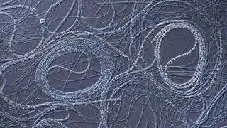 Filamentous Sulfur Bacteria Movement