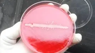 Satellitism test Positive of Haemophilus influenzae