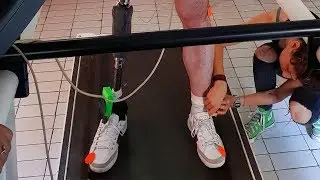 Bionic leg allows amputees to 