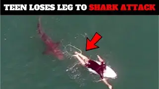 Teenager Loses Leg to Great White Shark in Horrifying Attack Caught on Video
