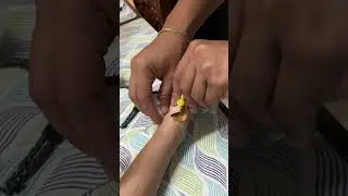 Wana removal of last IV heplock after 1 month (Feb 29, 2024)