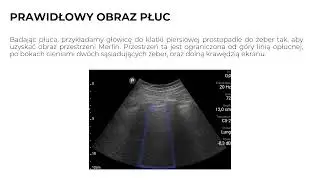 Pierwsze kroki w ultrasonografii płuc. Fundacja Mocni na starcie
