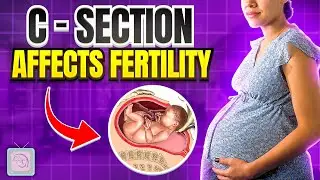 Are you having trouble trying to conceive again? It might be because of your C-Section