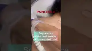 Painless laser hair removal