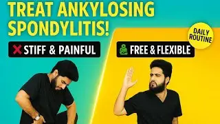 Best Stretches & Exercises for Ankylosing Spondylitis | Relieve Pain & Improve Mobility