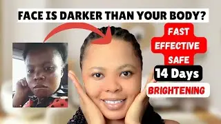 LIGHTEN DARK FACE IN 14 DAYS | FACE CREAM,FACE SOAP,FACE CLEANSER