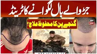 Best And Safest Hair Transplant Method