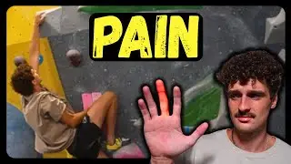 This Pulley Injury Shouldn't Keep You From Training