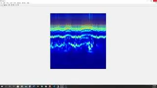 Classifying ECG Signals in Simulink Using Convolutional Network (Deep Learning)