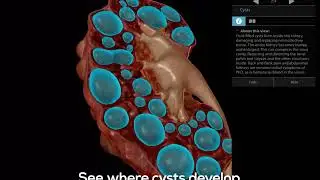 Visible Body | Physiology & Pathology - How to work through a lesson [PROMO]