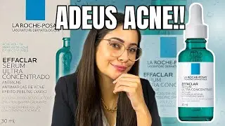 La Roche-Posay Effaclar Sérum Ultra Concentrado: Elimine Acne, Marcas e Poros Dilatados!!