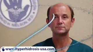 Dr. Dave Show - Top 5 Axillary Hyperhidrosis Treatments - Dr David Nielson
