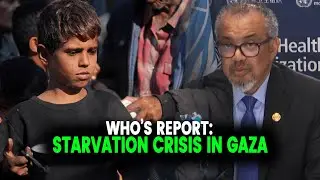 WHO&rsquo;s Report: 12,000 Gaza Children Face Acute Malnutrition | Pakistan Observer