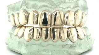 How to buy grillz from Seattle Gold Grills