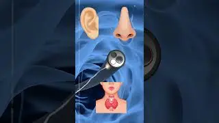 What is Video Endoscopy at Home &ndash; Expert ENT Care at Your Doorstep! 🏡👂 #entcare #entelite
