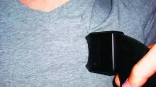 Stun Gun Mishap