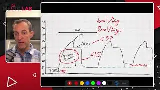 Mechanical Ventilation Fundamentals: 