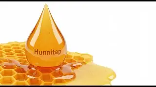Hunnitap Sunday Viewer Tag Up to Decide Next Songs for Gigs!