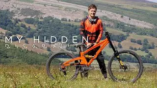 James Anderson - My Hidden Disability