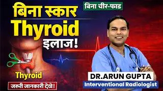Operation ke bina? Thyroid Nodule Non-Surgical Treatment | Dr Arun Gupta