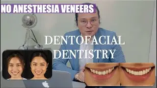 Indirect Veneers without Anesthesia | Dentofacial Dentistry | Apostol Dental Philippines