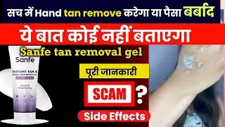 Sanfe Tan Removal Gel For Hands - Tan Remove करेगा या पैसा बर्बाद? Sanfe Gel Review