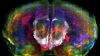 Unlocking the future of Neuroscience