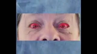Insta Eyes