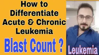 Acute and Chronic  Leukaemia Difference  30%  or 20 % Blast
