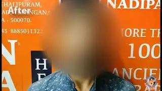 2 cm height gain in 2 days | Nadipathy treatment | with CC