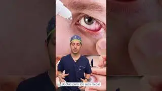 NO lo hagas, si tienes ojo rojo‼️👁️