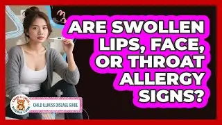 Are Swollen Lips, Face, Or Throat Allergy Signs?