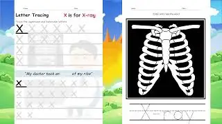 Tracing & Colouring Alphabet X Vol 1  #learning #toddlers #alphabet #colour #toddlersongs #amomkh