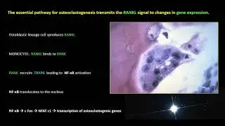 Learning Bone Growth 3:  The Osteoclast (2020)