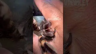 Tarantula Fang Anchoring!!!
