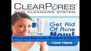 A Closer Look At ClearPores The Product!
