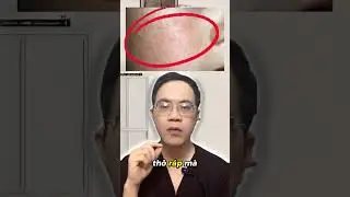 Da d&agrave;y sừng, mụn ẩn nhiều. L&agrave;m sao để cải thiện?