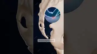 Coccyx Fracture: Injury at the Base of the Spine in 3D