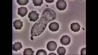 Bela krvna zrnca protiv bakterije (sa muzičkom podlogom)