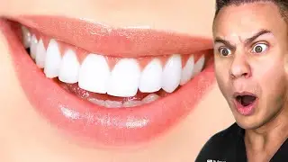 Dentist Reveals The Secret For The PERFECT Smile!